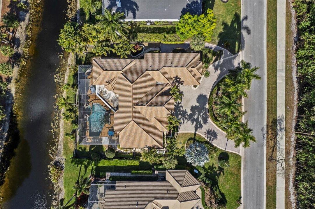 Overhead