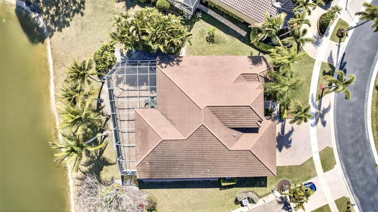 Overhead