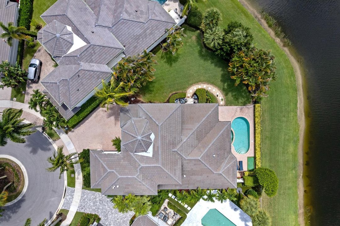 Overhead