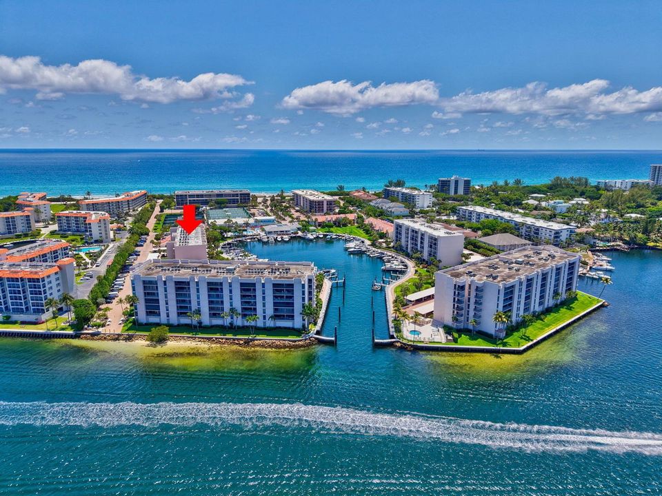 Intracostal