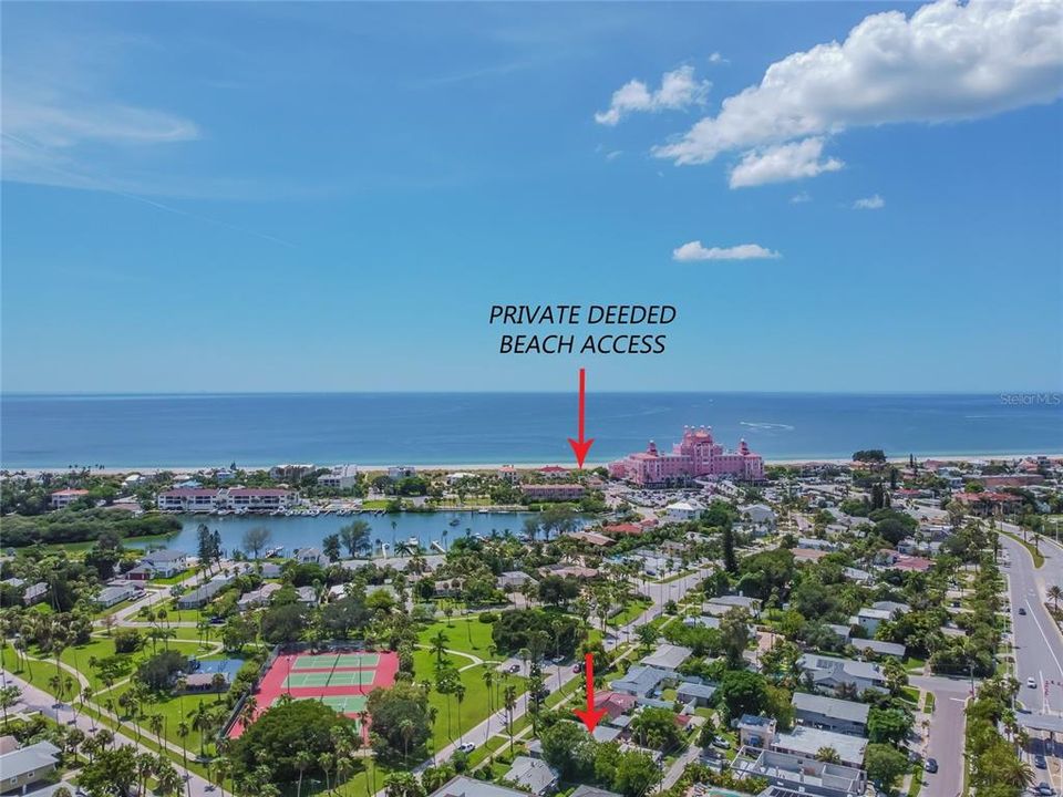 View of Lazarillo Park, Private Deeded Beach Access, The Don CeSar, St Pete Beach, Pass-A-Grill Beach and Location of Property!