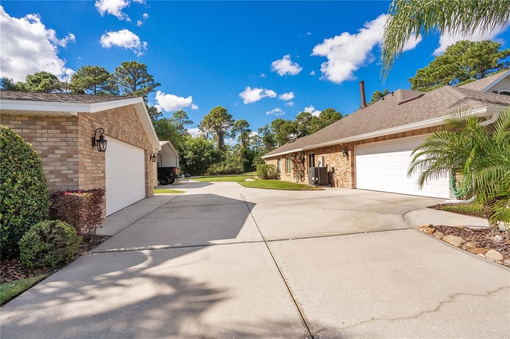 detached and attached garage face eachother