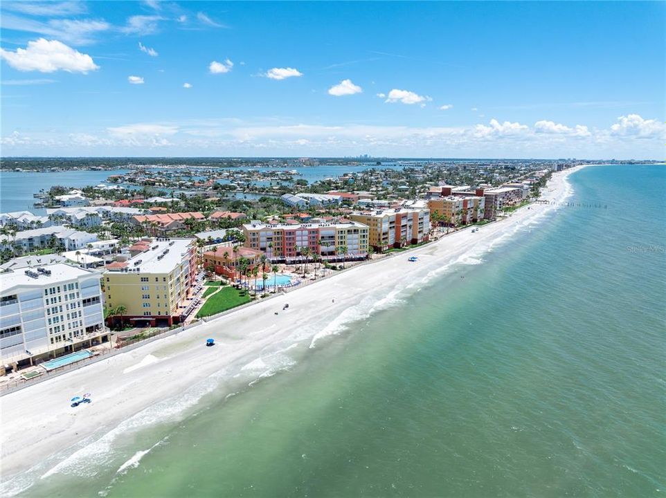 Под контрактом: $1,100,000 (3 спален, 2 ванн, 1560 Квадратных фут)