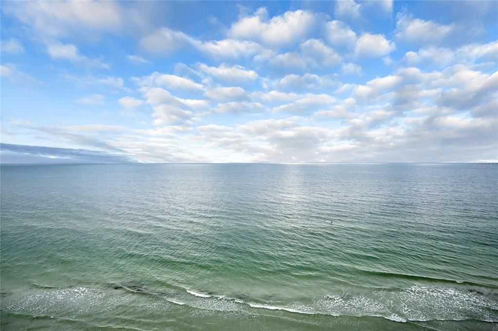 Под контрактом: $1,100,000 (3 спален, 2 ванн, 1560 Квадратных фут)